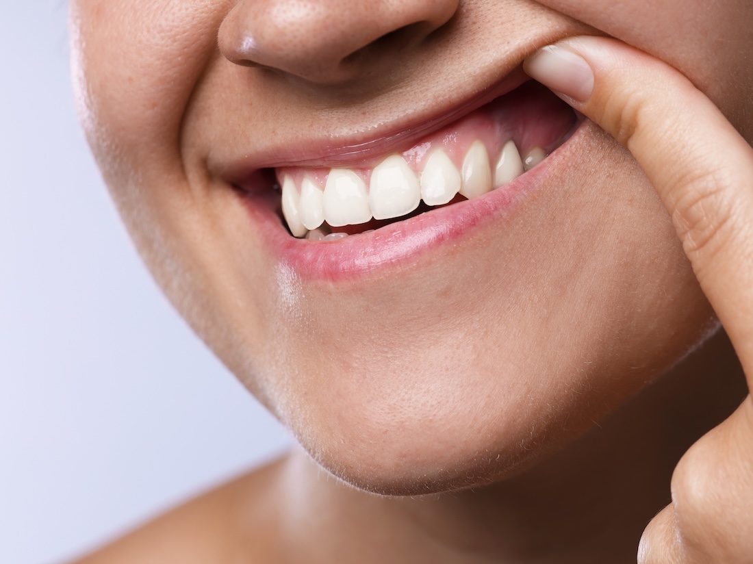 A smiling person lifting their upper lip to show off their gums